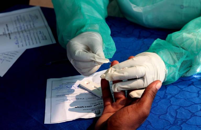 Lunda-Sul com escassez de testes serológicos